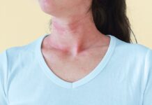 Детокс-дієти та шкірні висипання: що вам потрібно знати