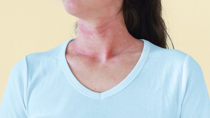 a69c81f4-58a1-4043-9684-28d9f773a8f7