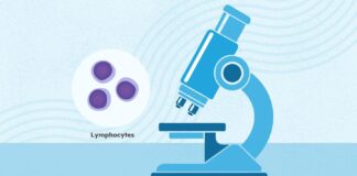 Leucemia Linfocítica Crônica (LLC): Uma Visão Geral Abrangente