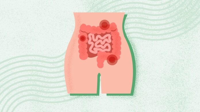 5a561fe9-09c9-43e0-87d4-2f9fa42d9eea